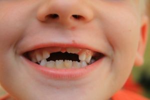 Deset težav povezanih z vašimi zobmi